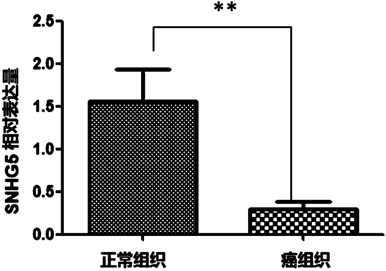 Application of SNHG5 (small nucleolar RNA host gene 5) in diagnosis, evaluation and efficacy prediction of breast cancer