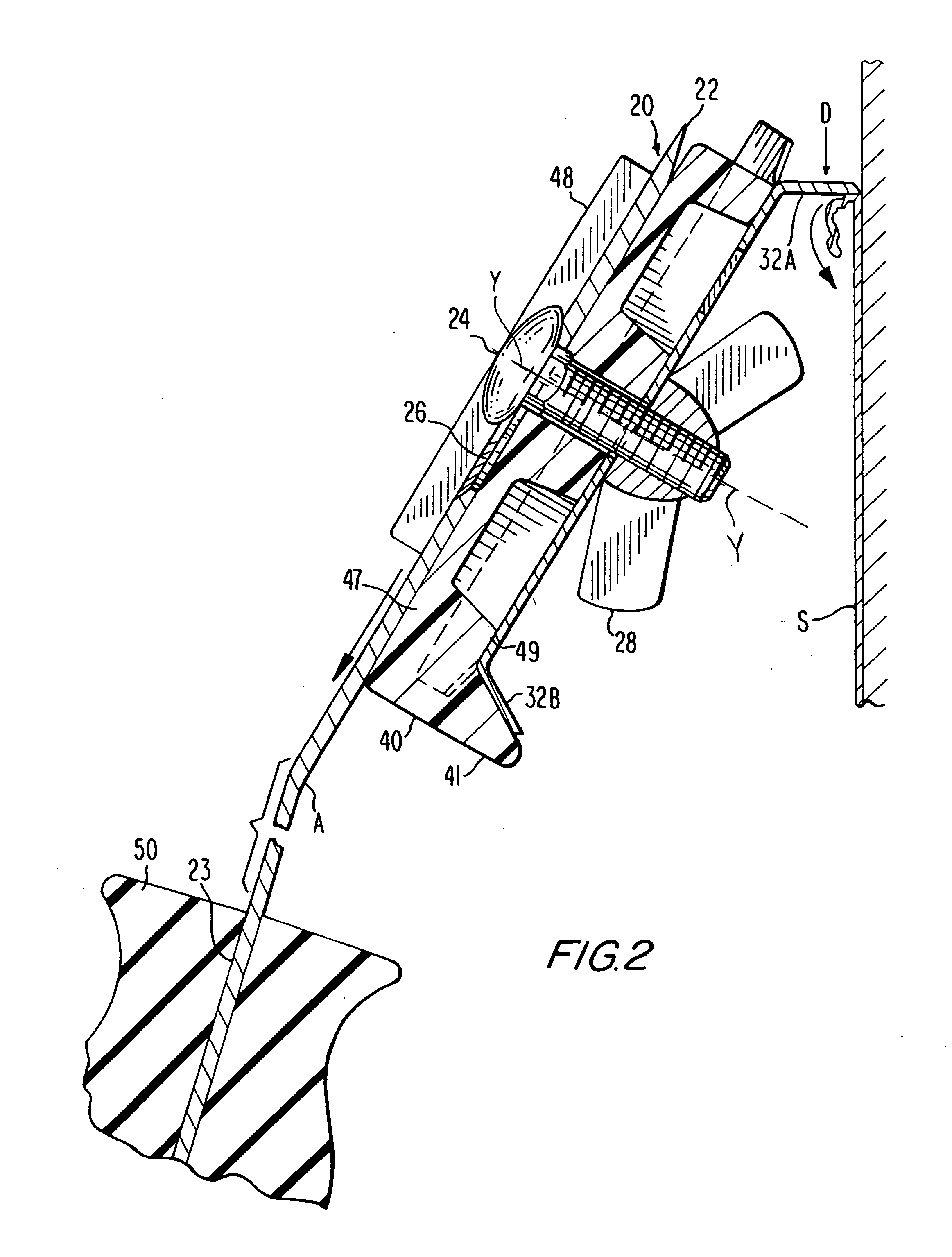 Push-pull stripper-scraper