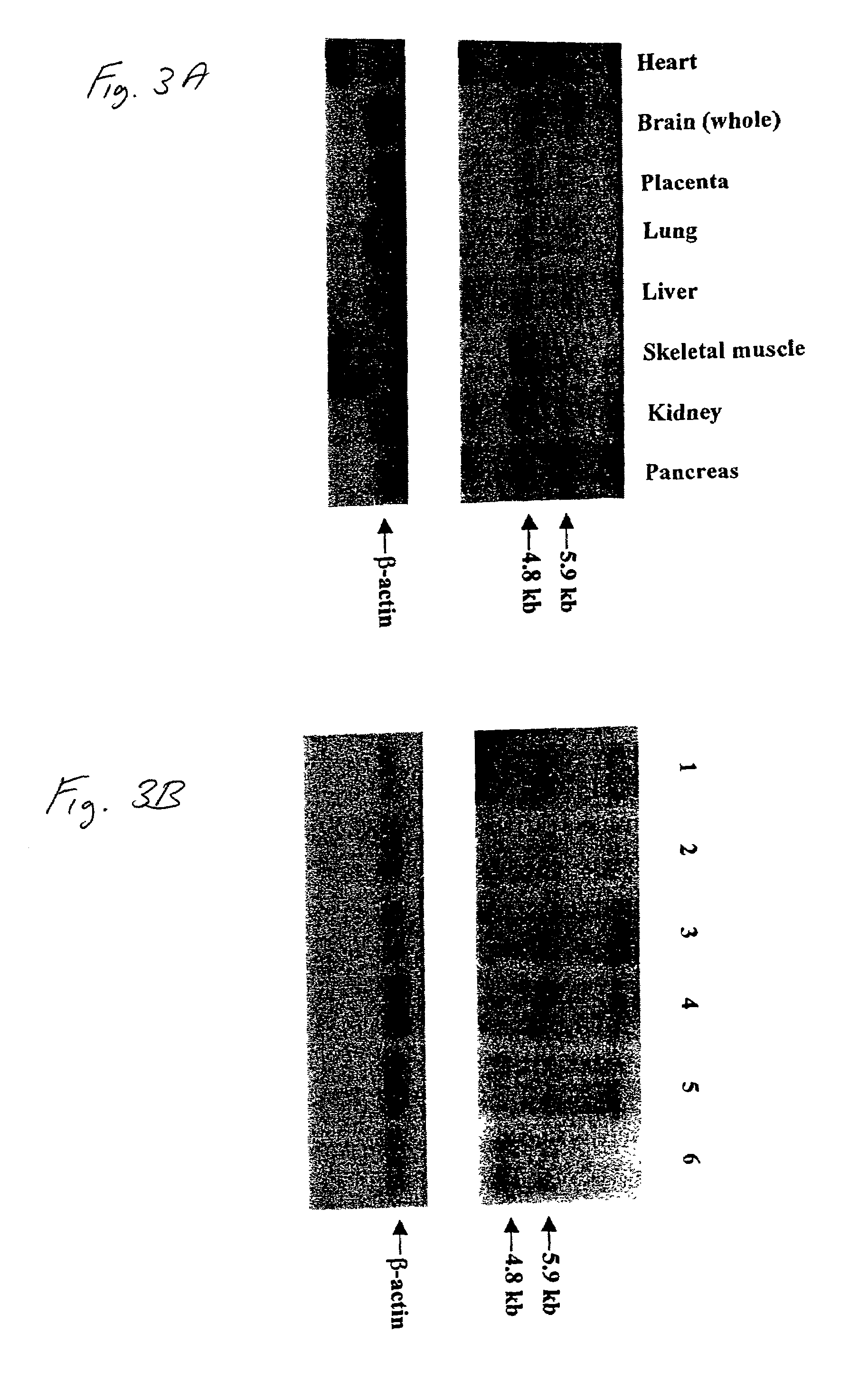 Gene for identifying individuals with familial dysautonomia