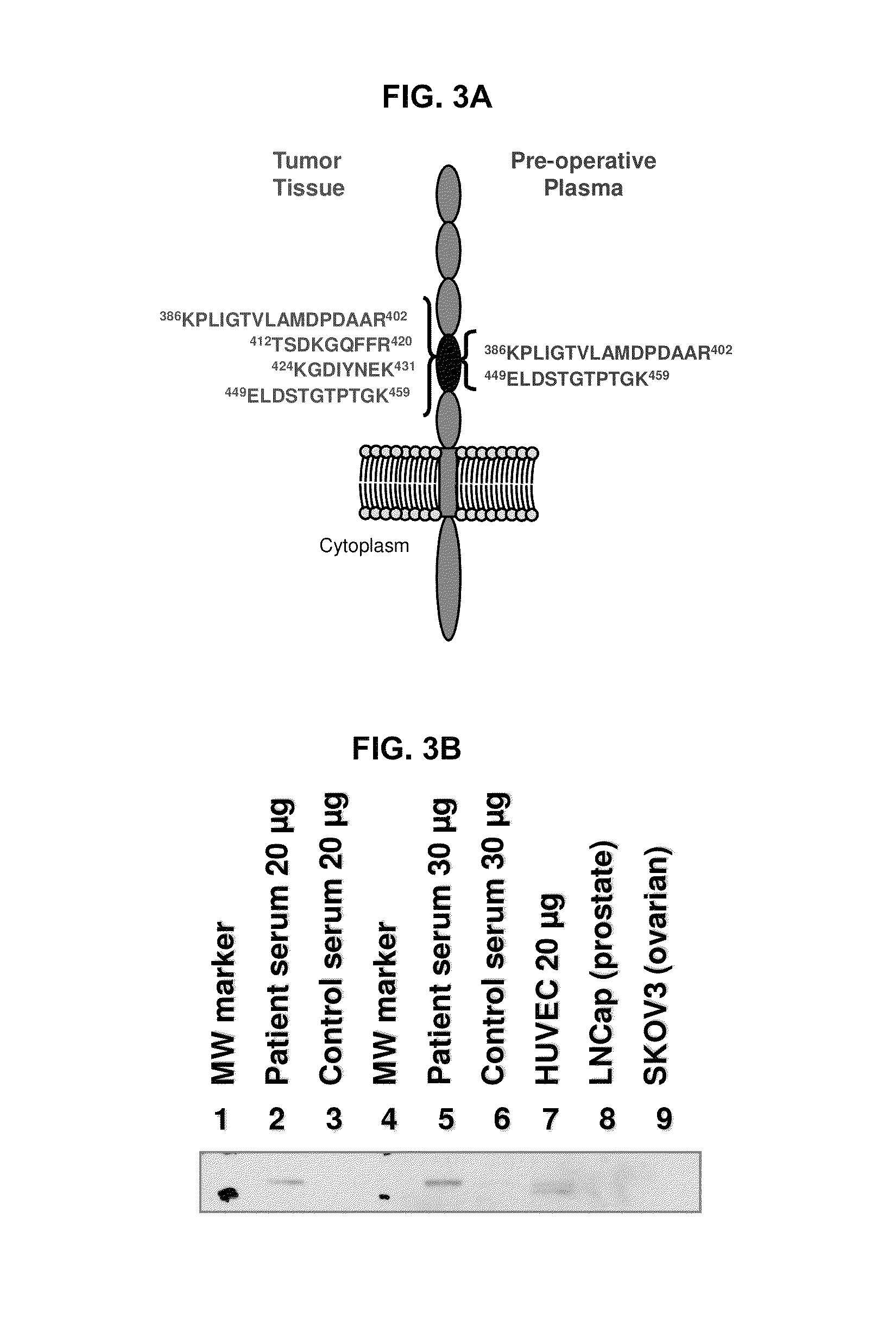 Renal cell carcinoma biomarkers