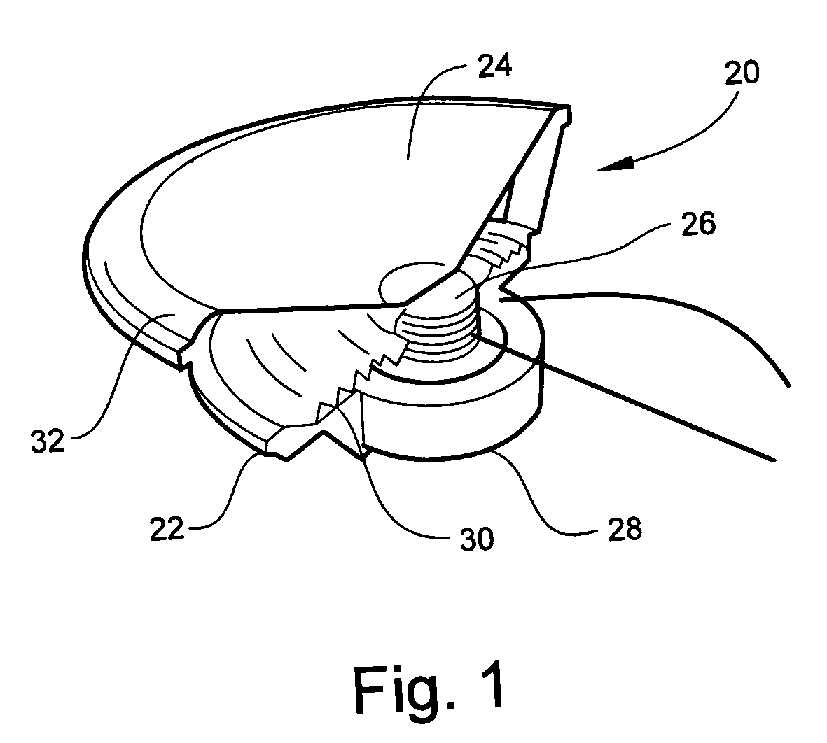 Tangential stress reduction system in a loudspeaker suspension