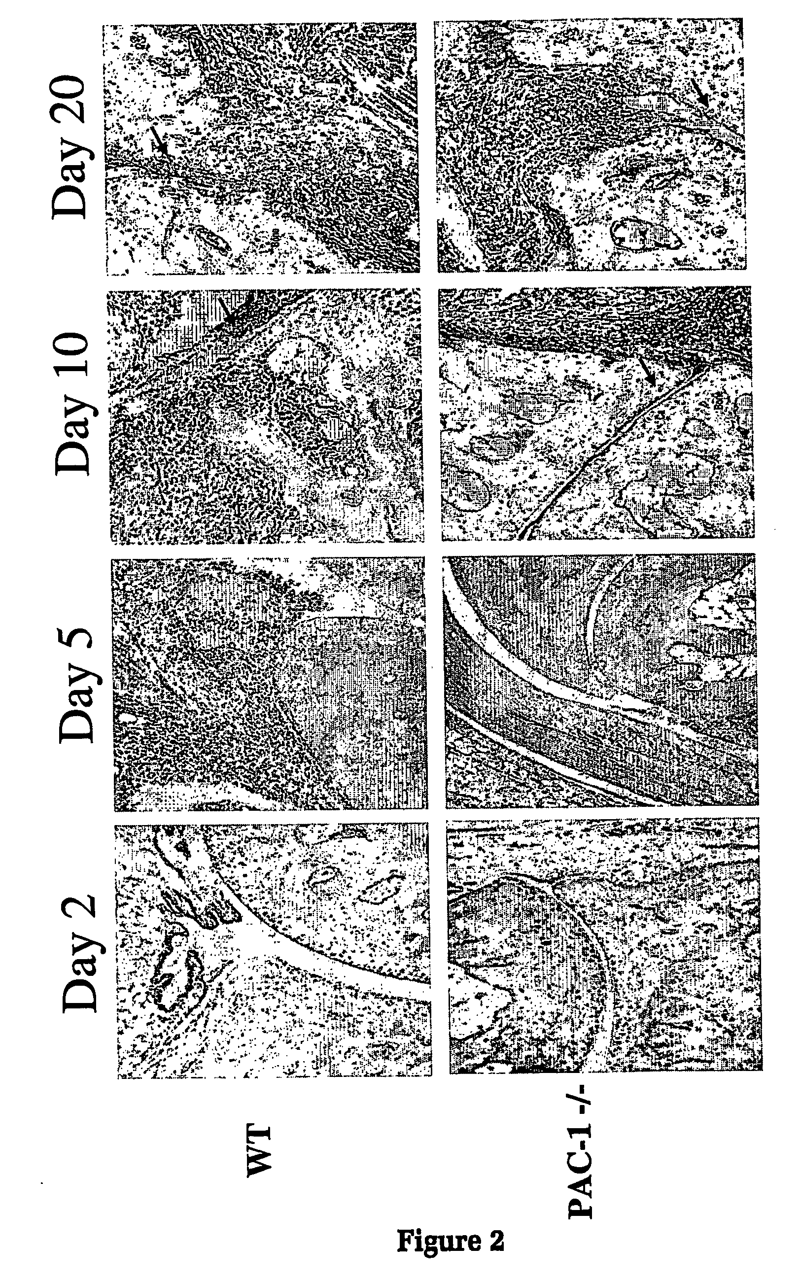 Methods of diagnosing and treating inflammatory diseases using pac-1 (dusp2)