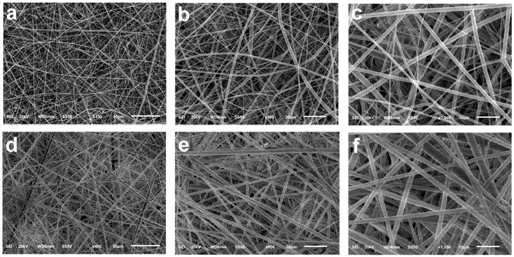 Curcumin loaded antibacterial fibrous membrane and preparation method thereof