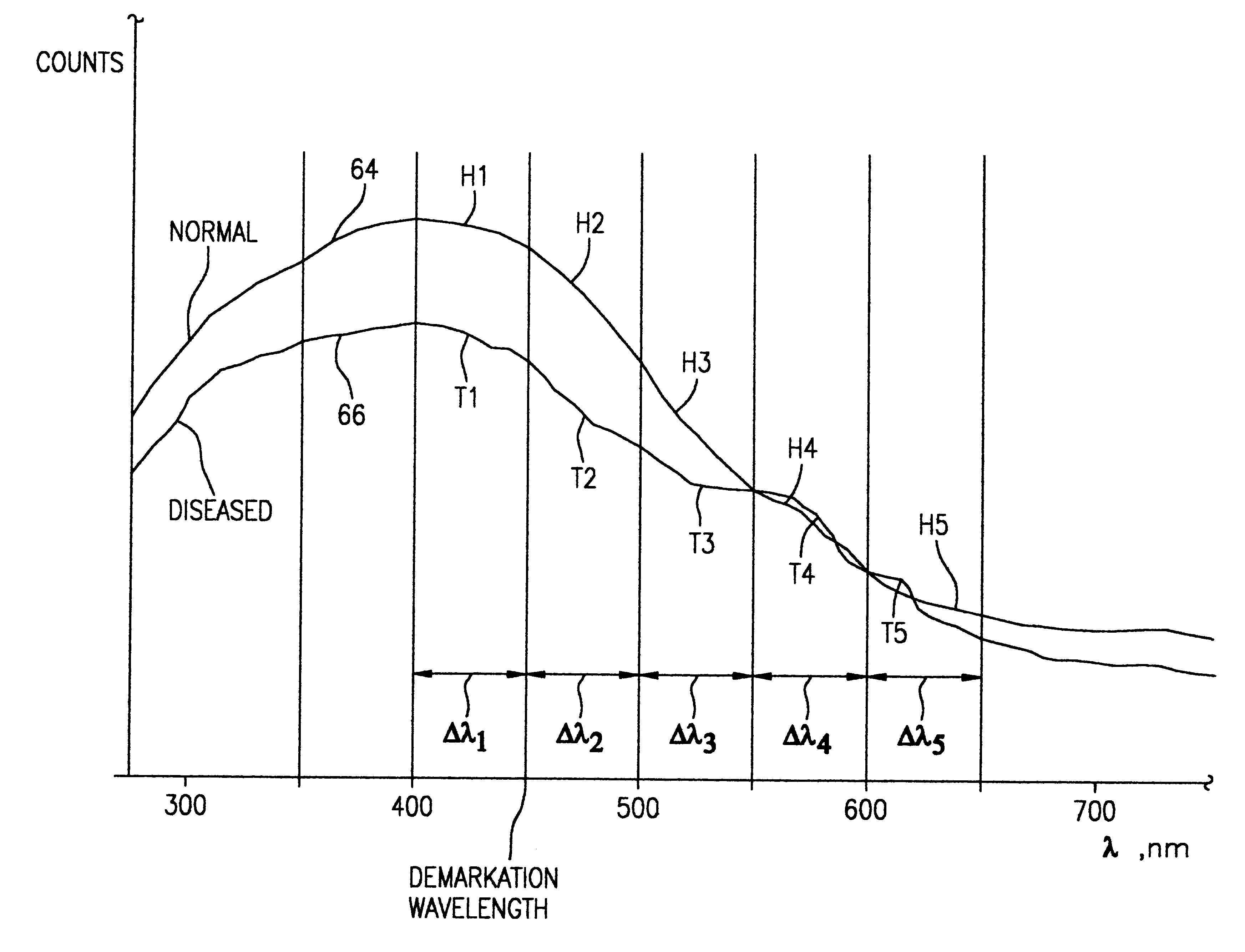 Optical instrument and technique for cancer diagnosis using in-vivo fluorescence emission of test tissue