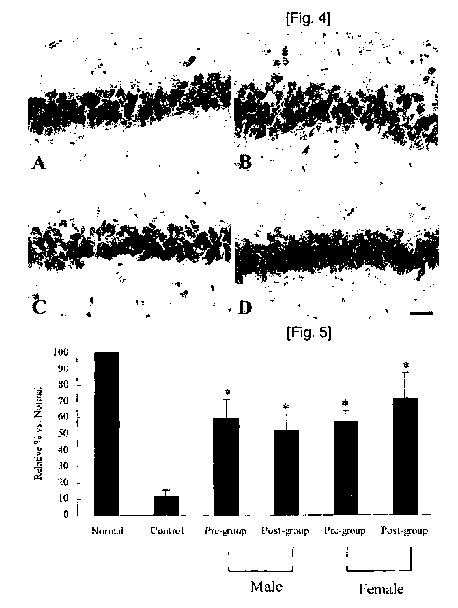 Grape seed extract having neuronal cell-protection activity and the composition comprising the same for preventing and treating degenerative brain disease