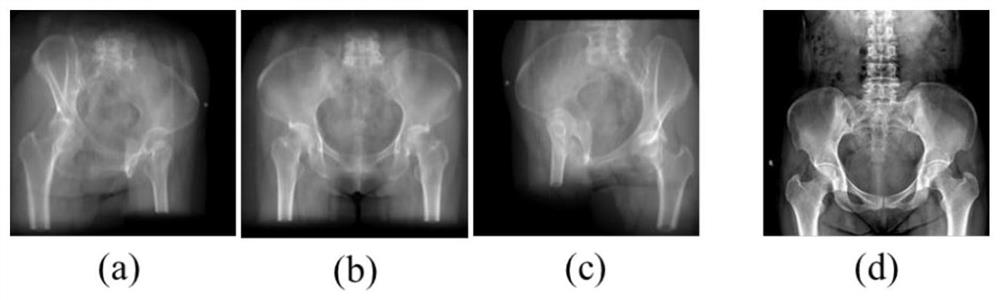 Hip joint segmentation model building method using small sample image training and application thereof