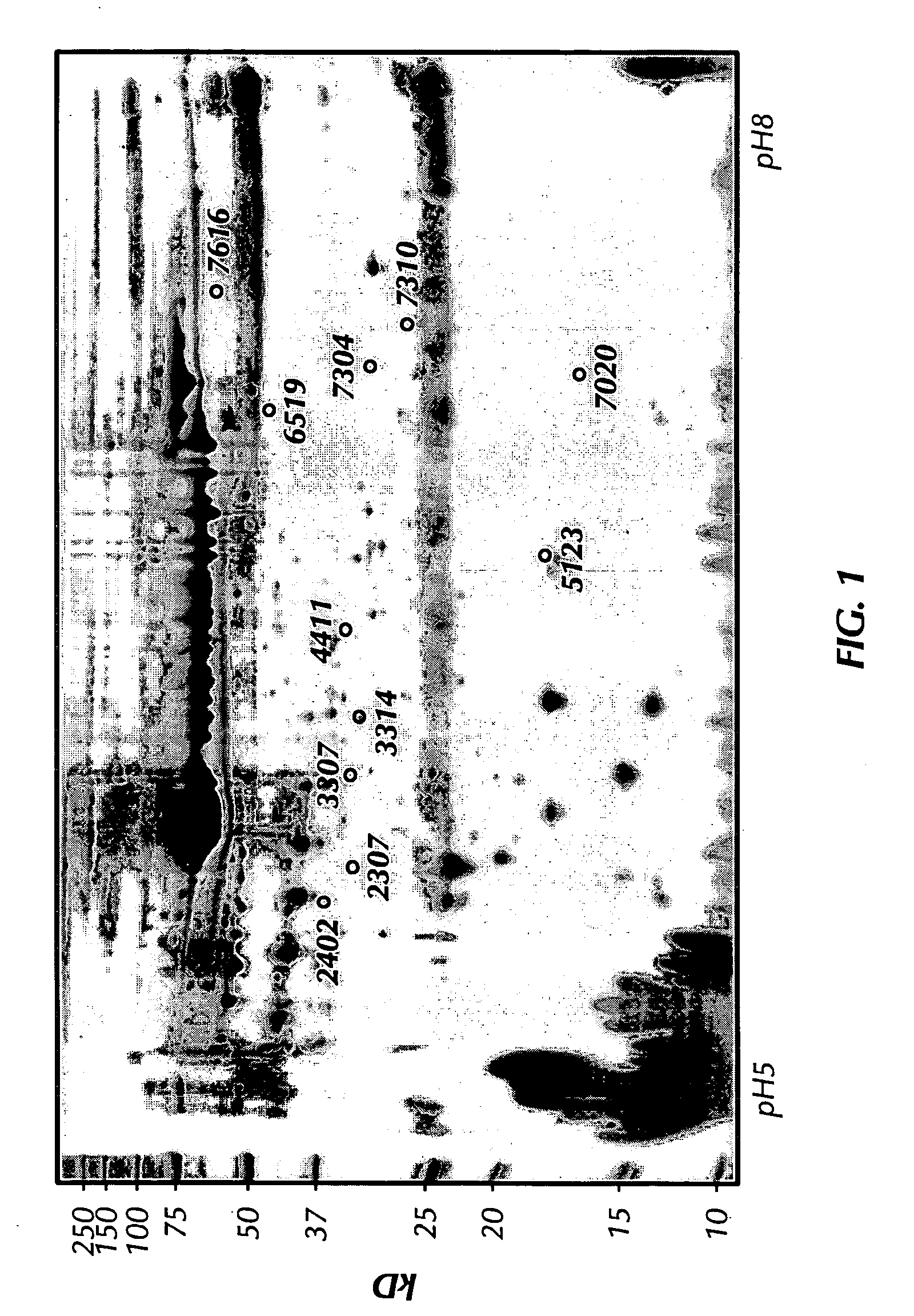 FK506-binding protein 7 related protein as a biomarker for neurodegenerative disease