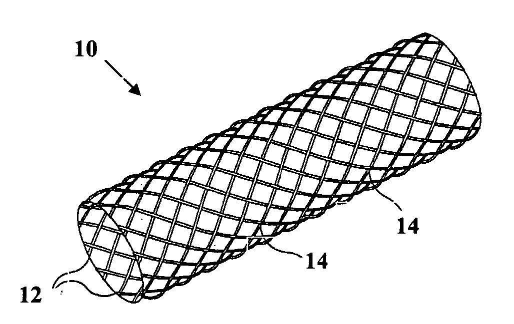 Metal reinforced biodegradable intraluminal stents