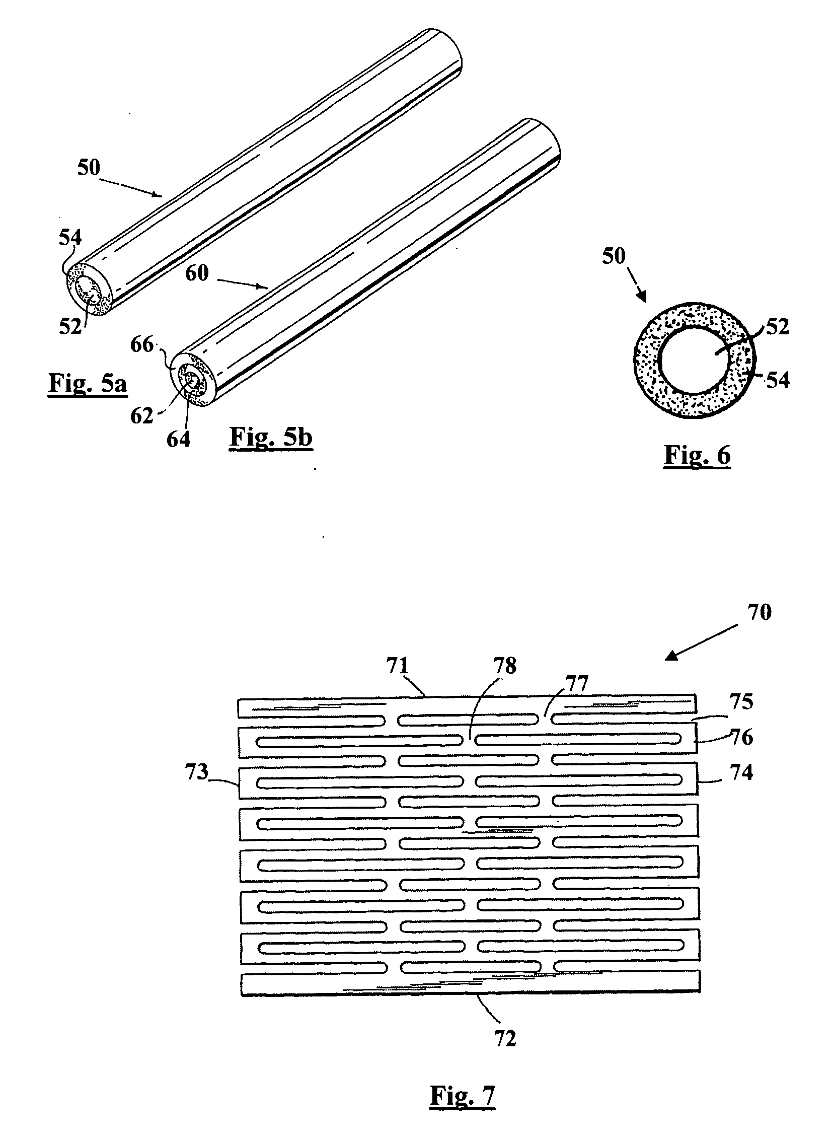 Metal reinforced biodegradable intraluminal stents