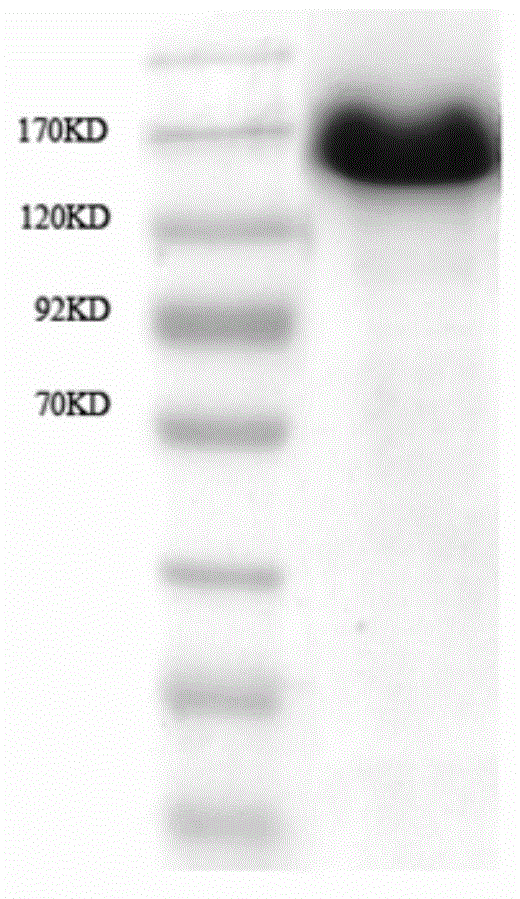 Use of antigen group in preparation of disease diagnosis kit and kit