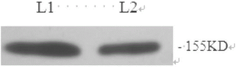 Use of antigen group in preparation of disease diagnosis kit and kit