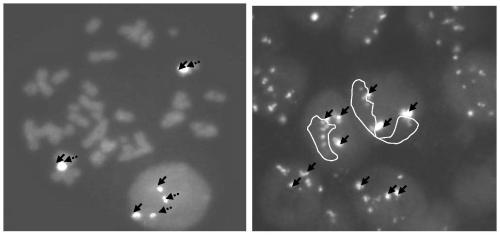 Probe group and kit used to detect HER-2 gene proliferation level and application thereof