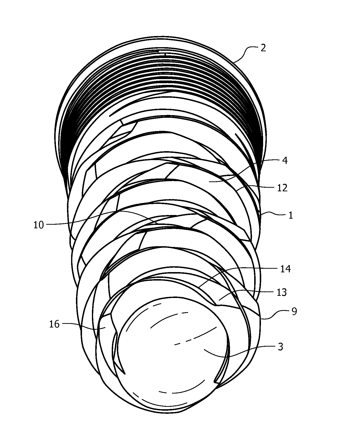 Self-Clearing Self-Cutting Implant