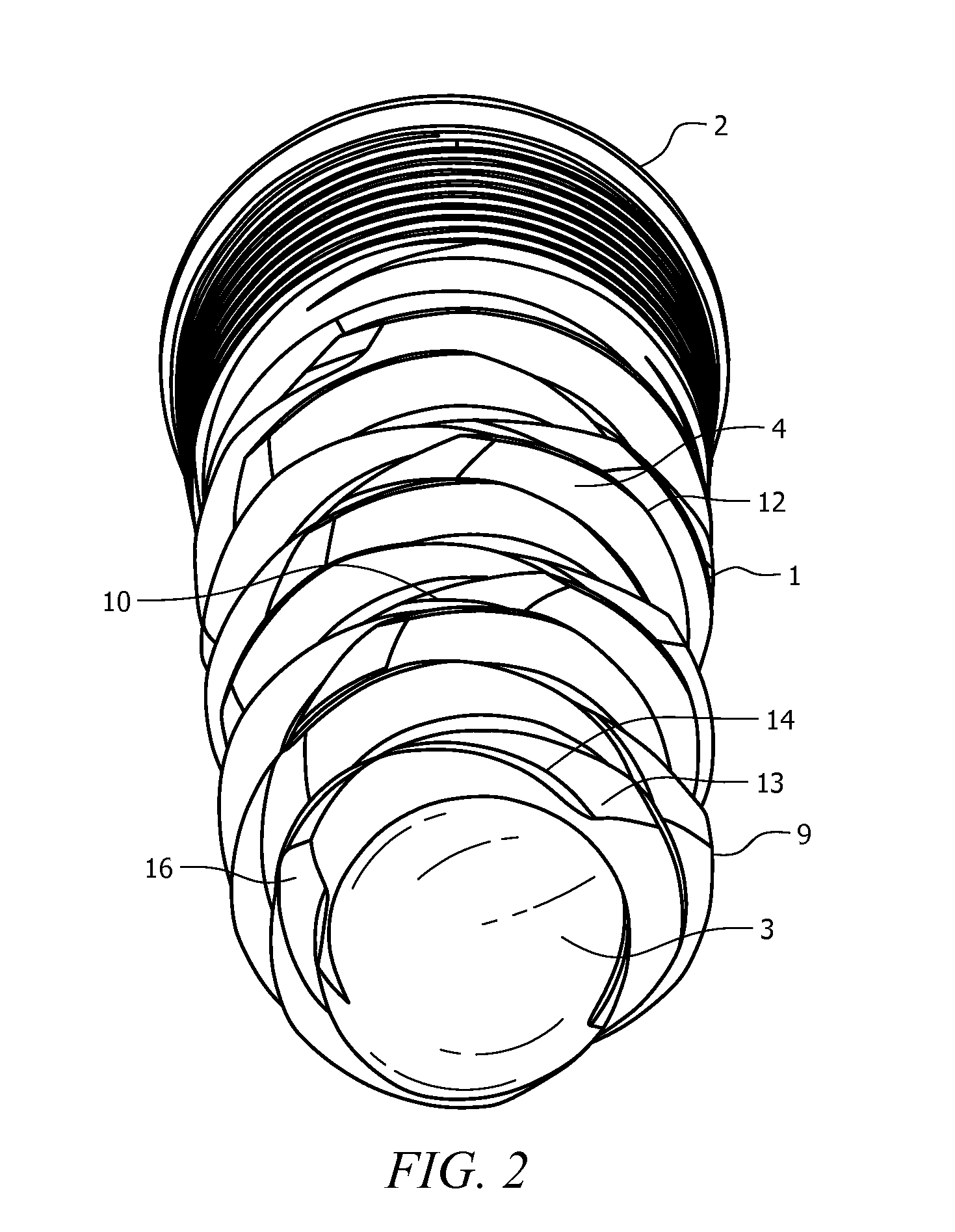 Self-Clearing Self-Cutting Implant