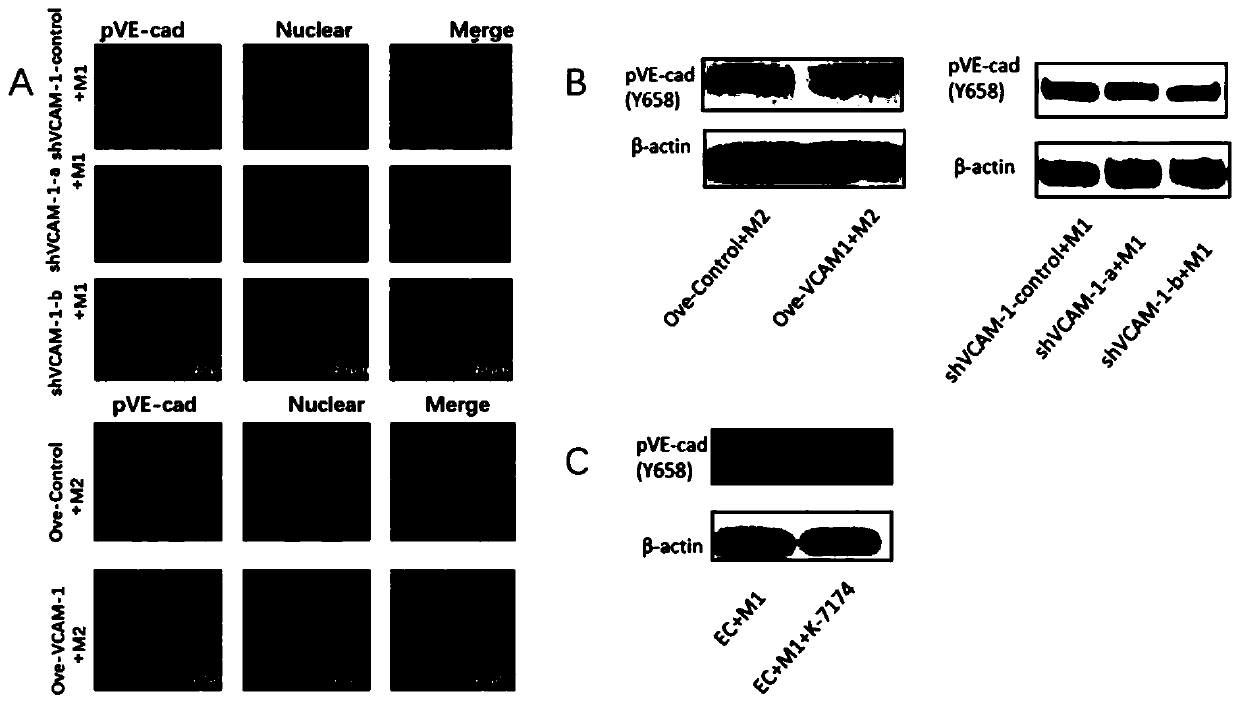 Application of macrophage in blood vessel barrier protection, and prevention, inhibition and treatment of ovarian cancer ascites