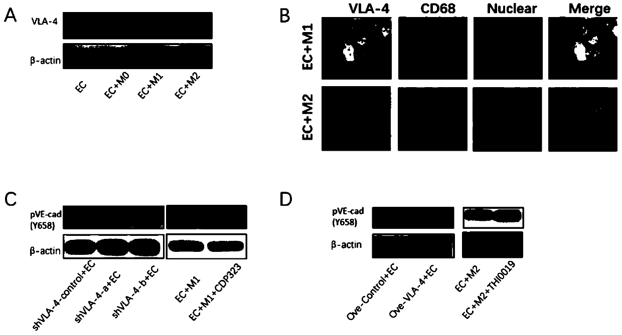 Application of macrophage in blood vessel barrier protection, and prevention, inhibition and treatment of ovarian cancer ascites