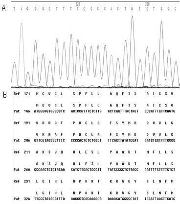 A kit for detecting drug-resistant mutations of hepatitis B virus