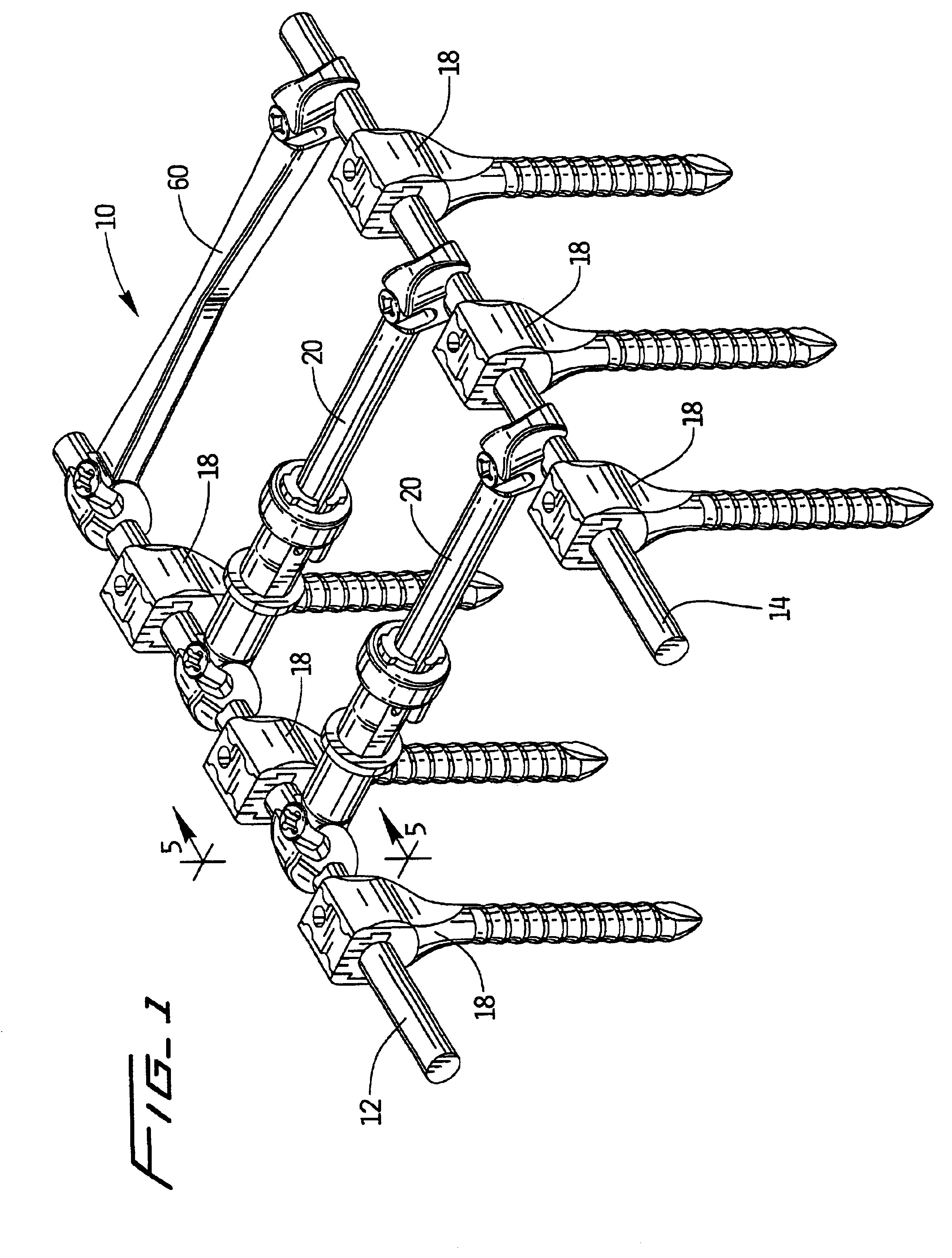 Apparatus for spinal stabilization