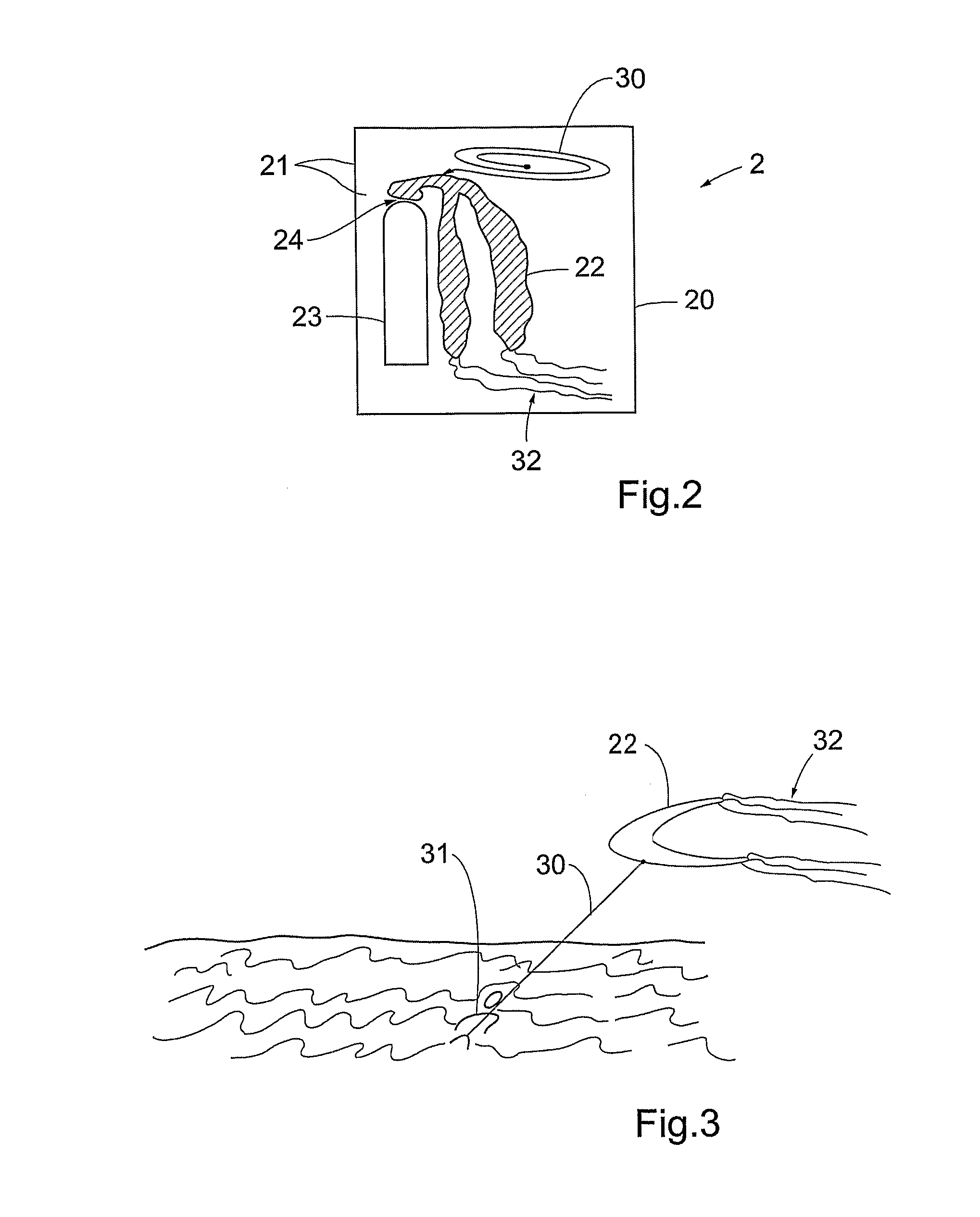 Location signaling device