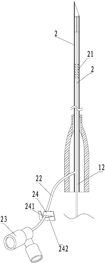 Lung nodular puncture locating needle