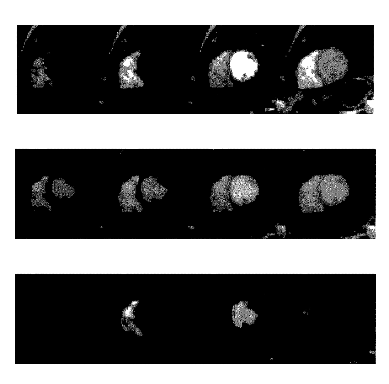 Low-Rank and Sparse Matrix Decomposition Based on Schatten p=1/2 and L1/2 Regularizations for Separation of Background and Dynamic Components for Dynamic MRI