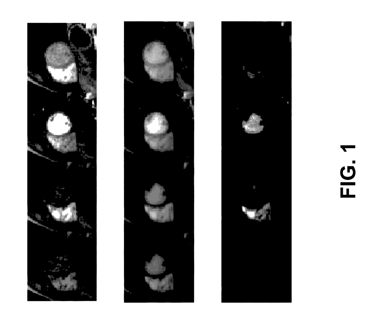 Low-Rank and Sparse Matrix Decomposition Based on Schatten p=1/2 and L1/2 Regularizations for Separation of Background and Dynamic Components for Dynamic MRI