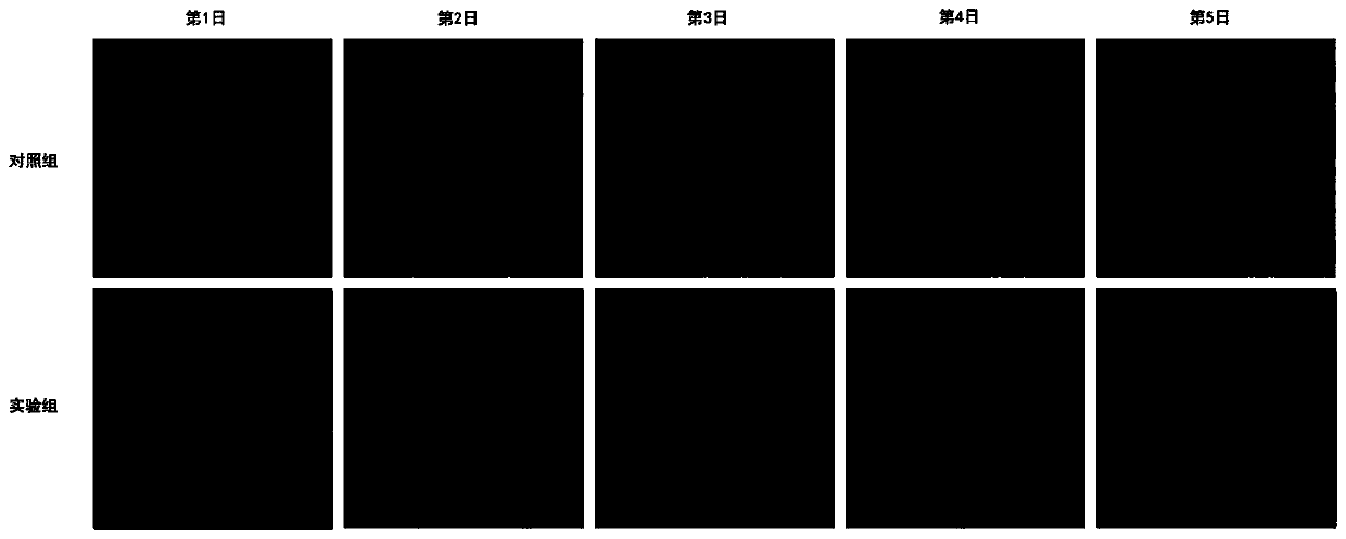 Application of EMC8 gene inhibitor on preparation of medicine for treating gastric cancer