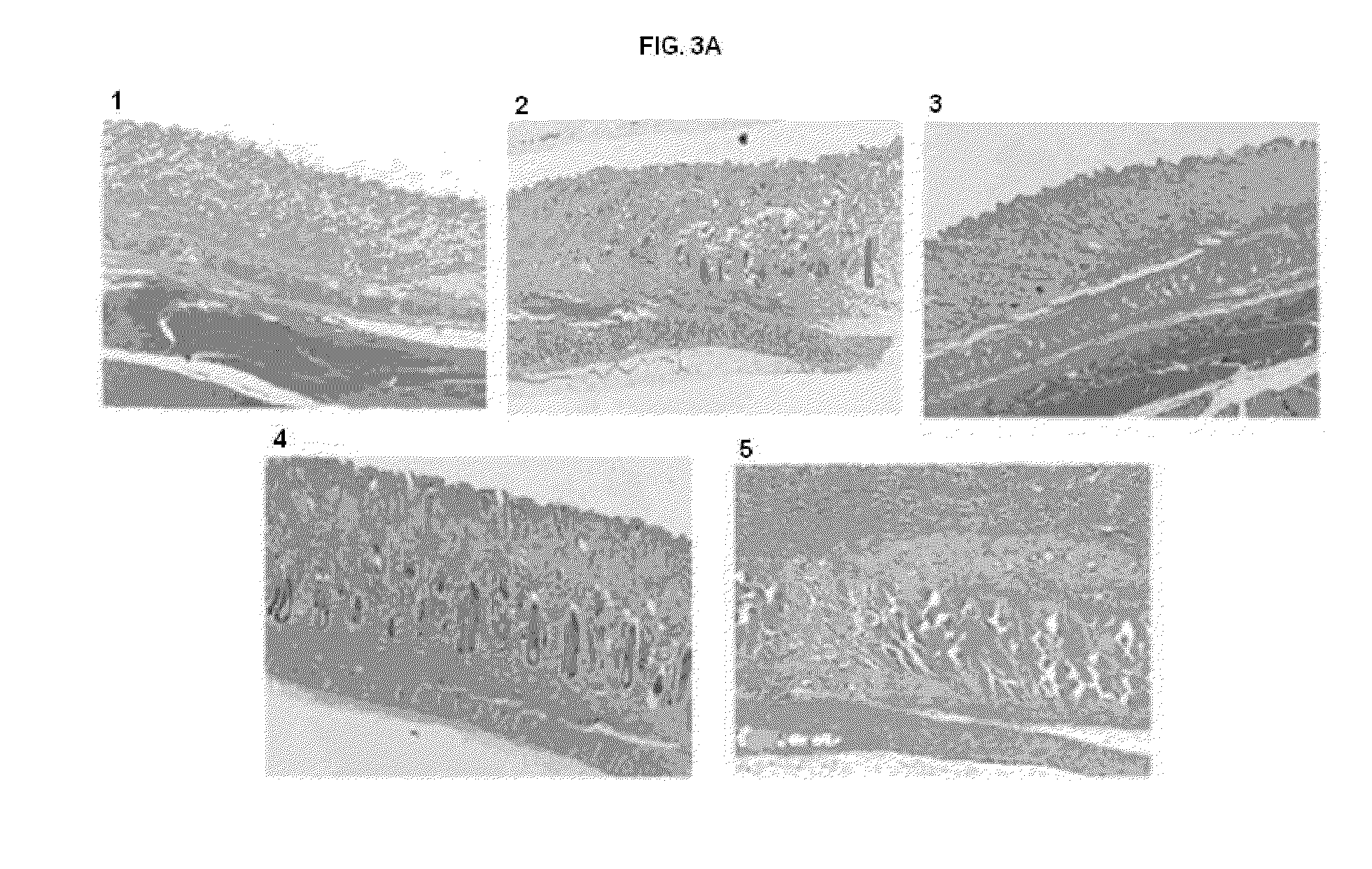 Method, composition, and article of manufacture for providing alpha-1 antitrypsin