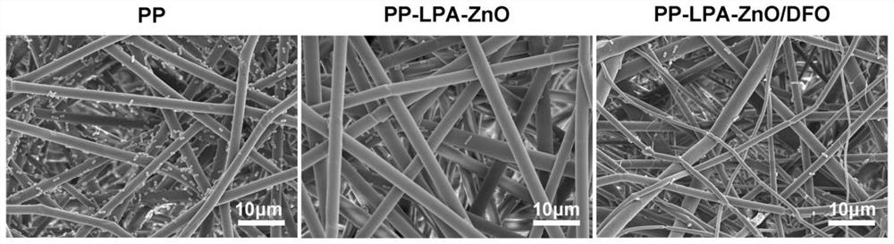 Preparation method of multifunctional electrospinning scaffold for bone regeneration