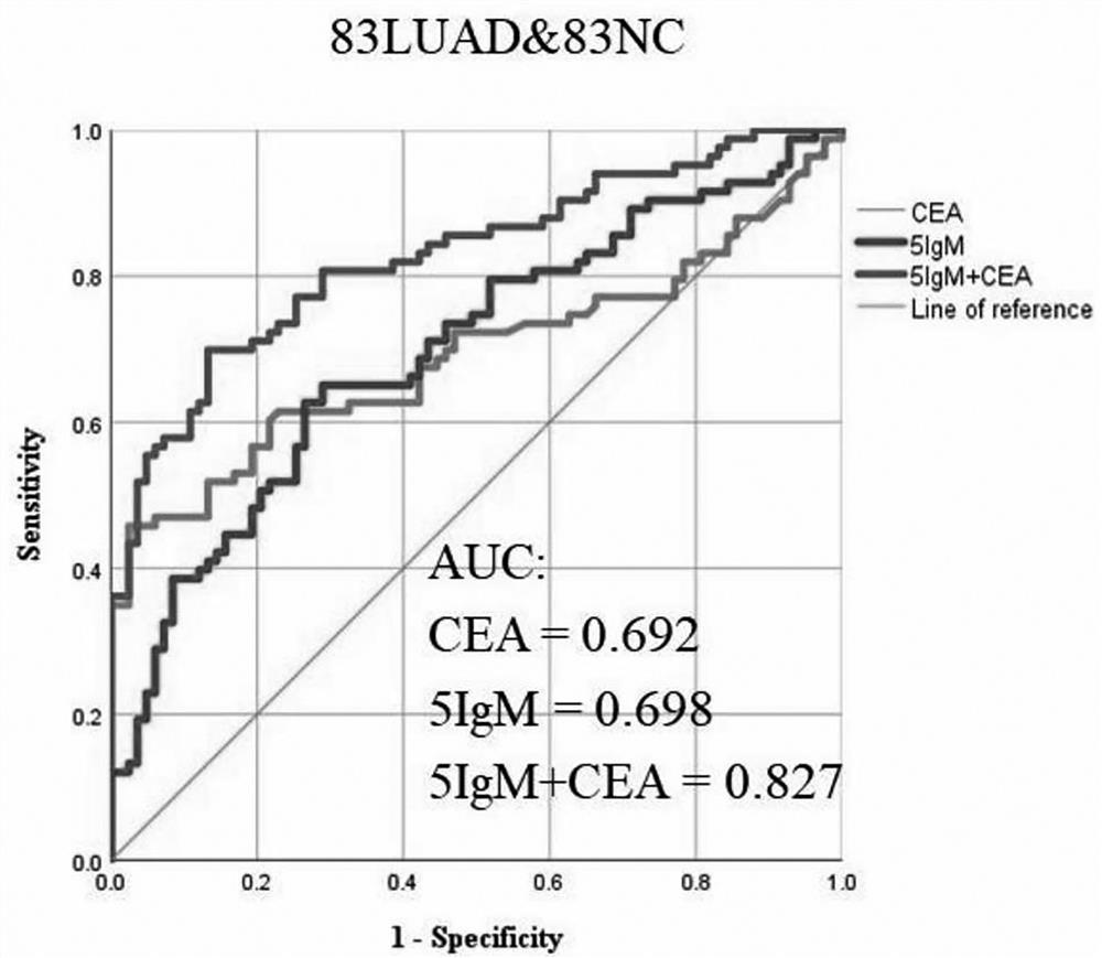 Joint detection serum marker for early diagnosis of lung adenocarcinoma and application of joint detection serum marker