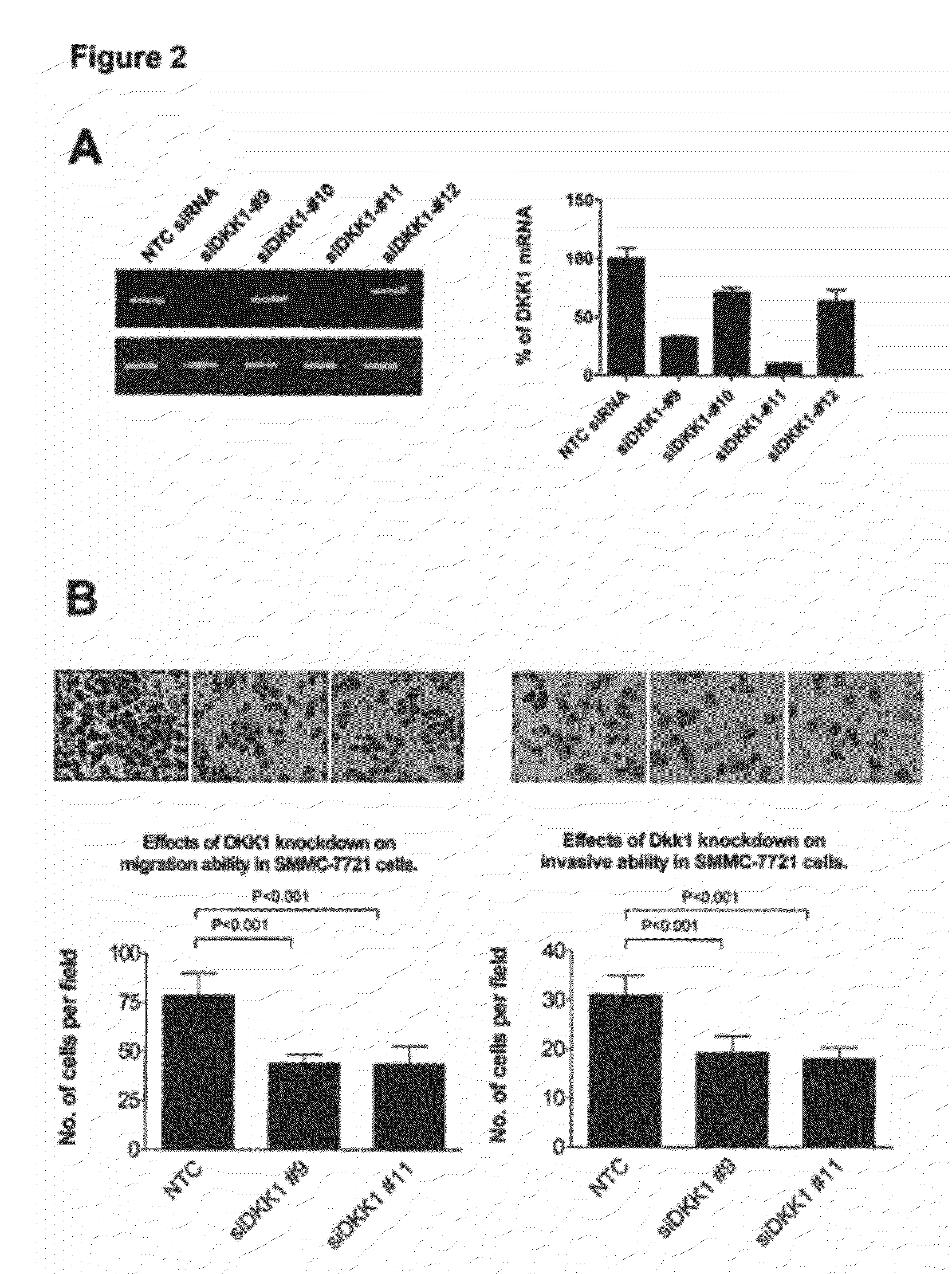 Use of Anti-DKK-1 Monoclonal Antibodies for the Treatment of Liver Cancer