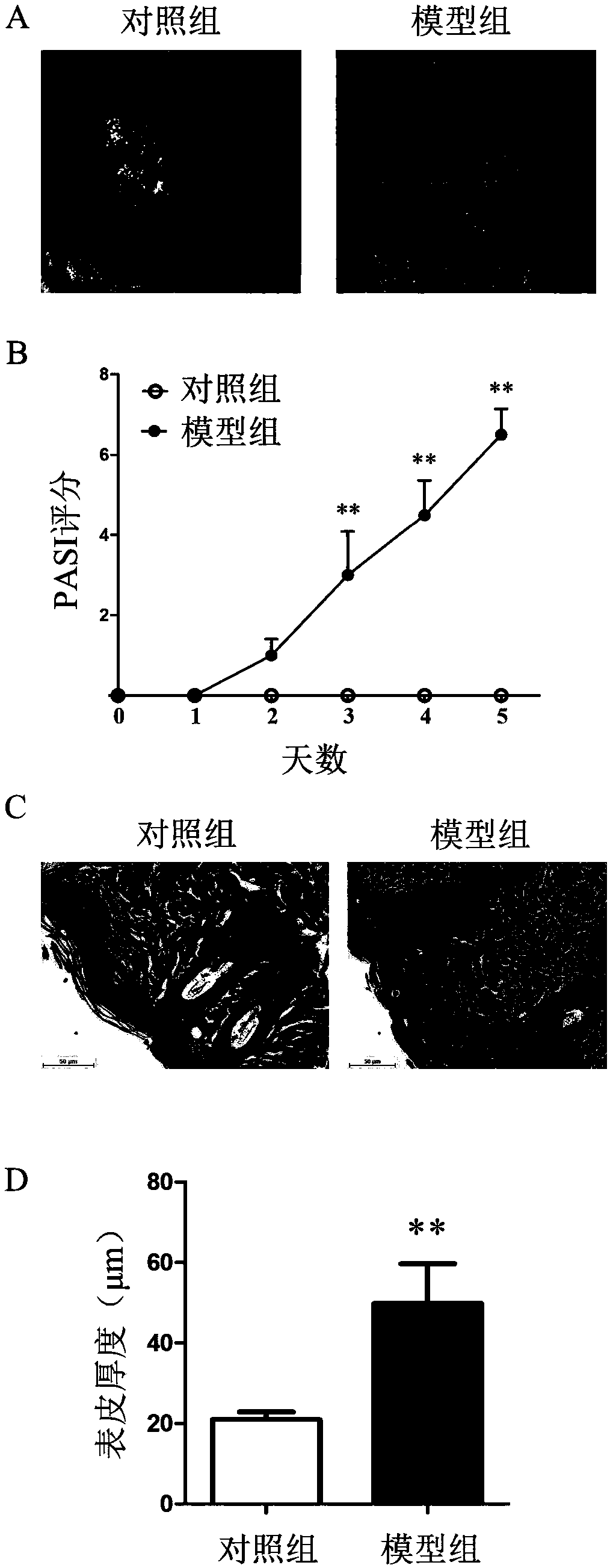 Application of transient receptor potential cation channel TRPV3 in development of medicines for preventing or treating psoriasis