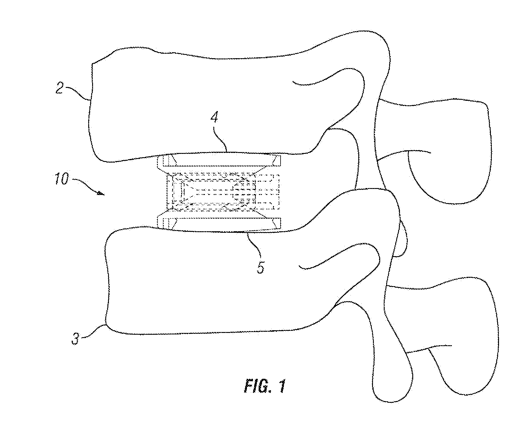 Expandable Fusion Device and Method of Installation Thereof