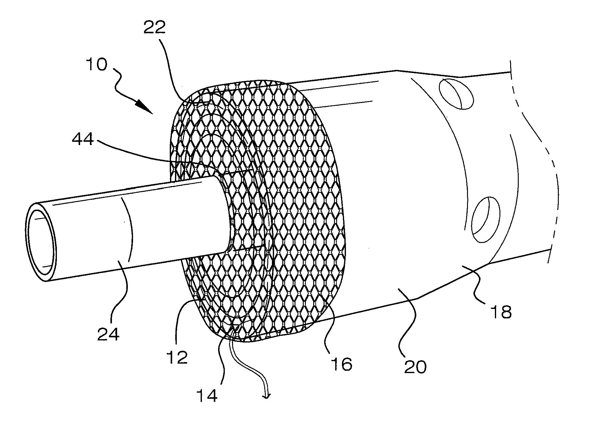 Viscerotomy closure device and method of use