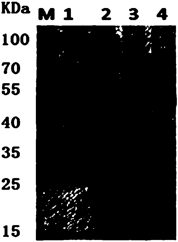 Nanometer antibody resistant to pseudomonas aeruginosa ectotoxin A and application of nanometer antibody