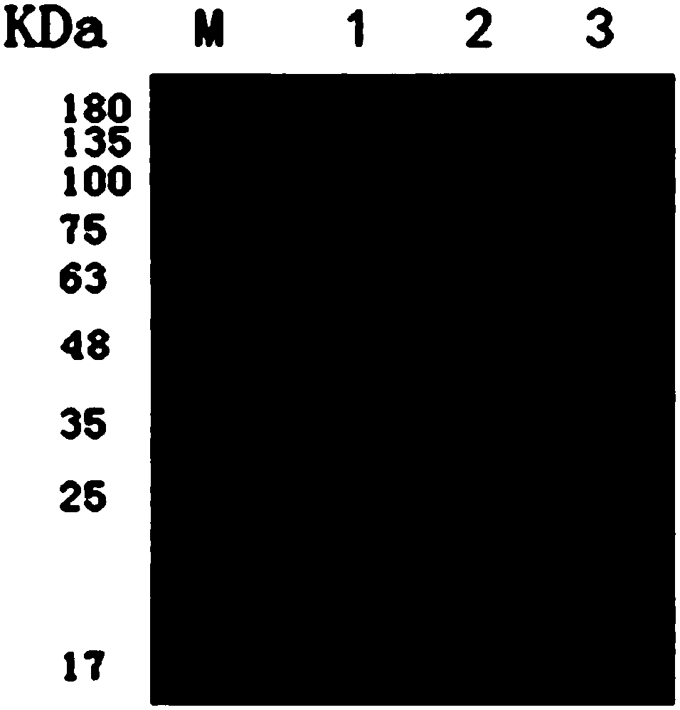 Nanometer antibody resistant to pseudomonas aeruginosa ectotoxin A and application of nanometer antibody