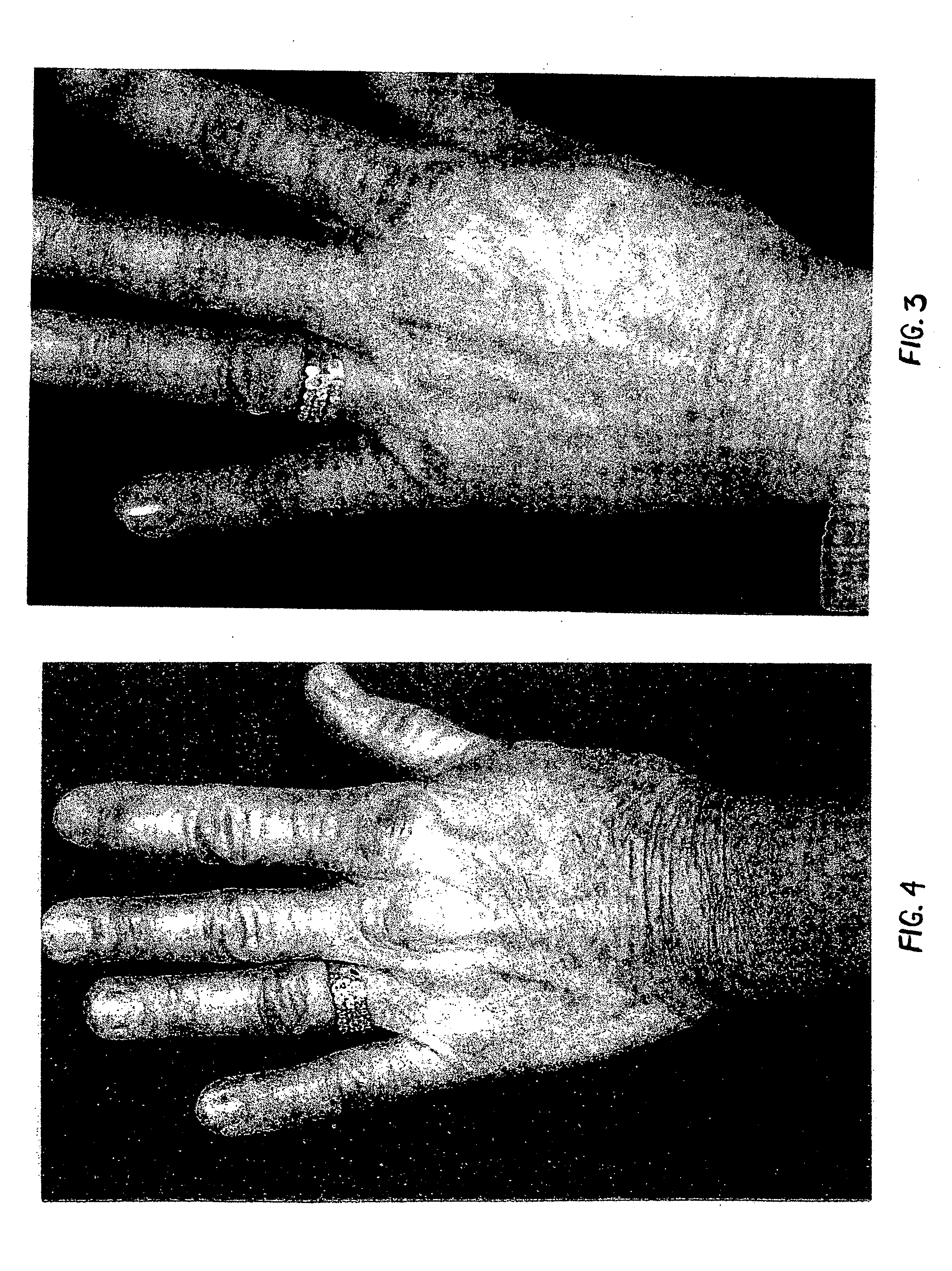 Topical compositions for anti-aging and methods of using same