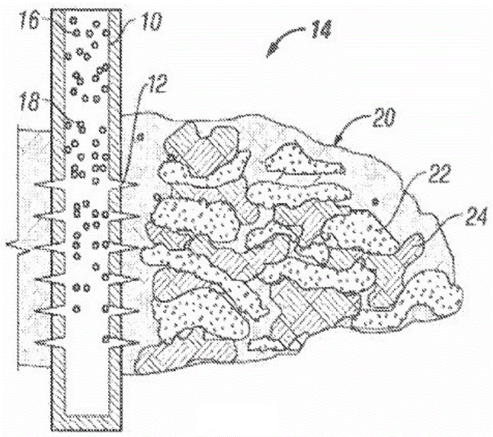 Uneven placement of proppants in fractures with removable extrametric material fills