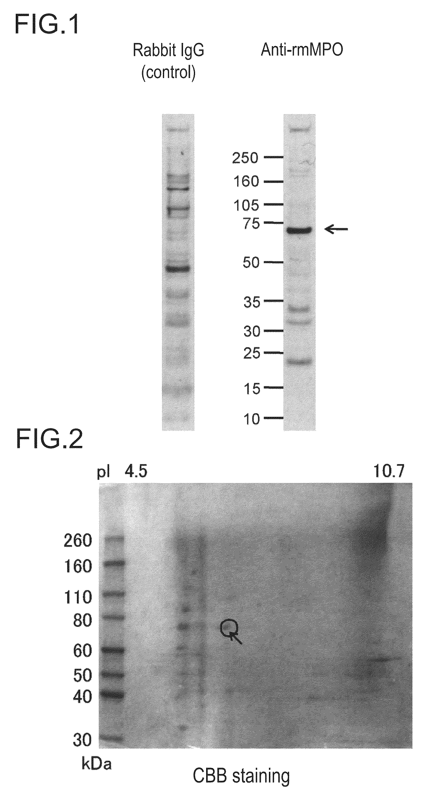 Testing method and testing reagent for angiitis