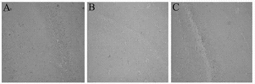 Application of non-steroidal anti-inflammatory medicines in preparation of medicine for preventing and treating diabetic encephalopathy