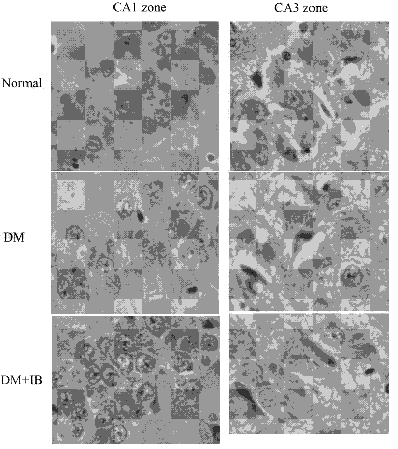 Application of non-steroidal anti-inflammatory medicines in preparation of medicine for preventing and treating diabetic encephalopathy