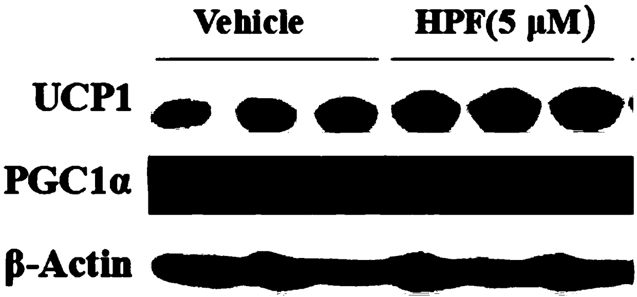 Application of hyperforin to preparation of medicine for promoting browning of white fat and improving activity of brown fat