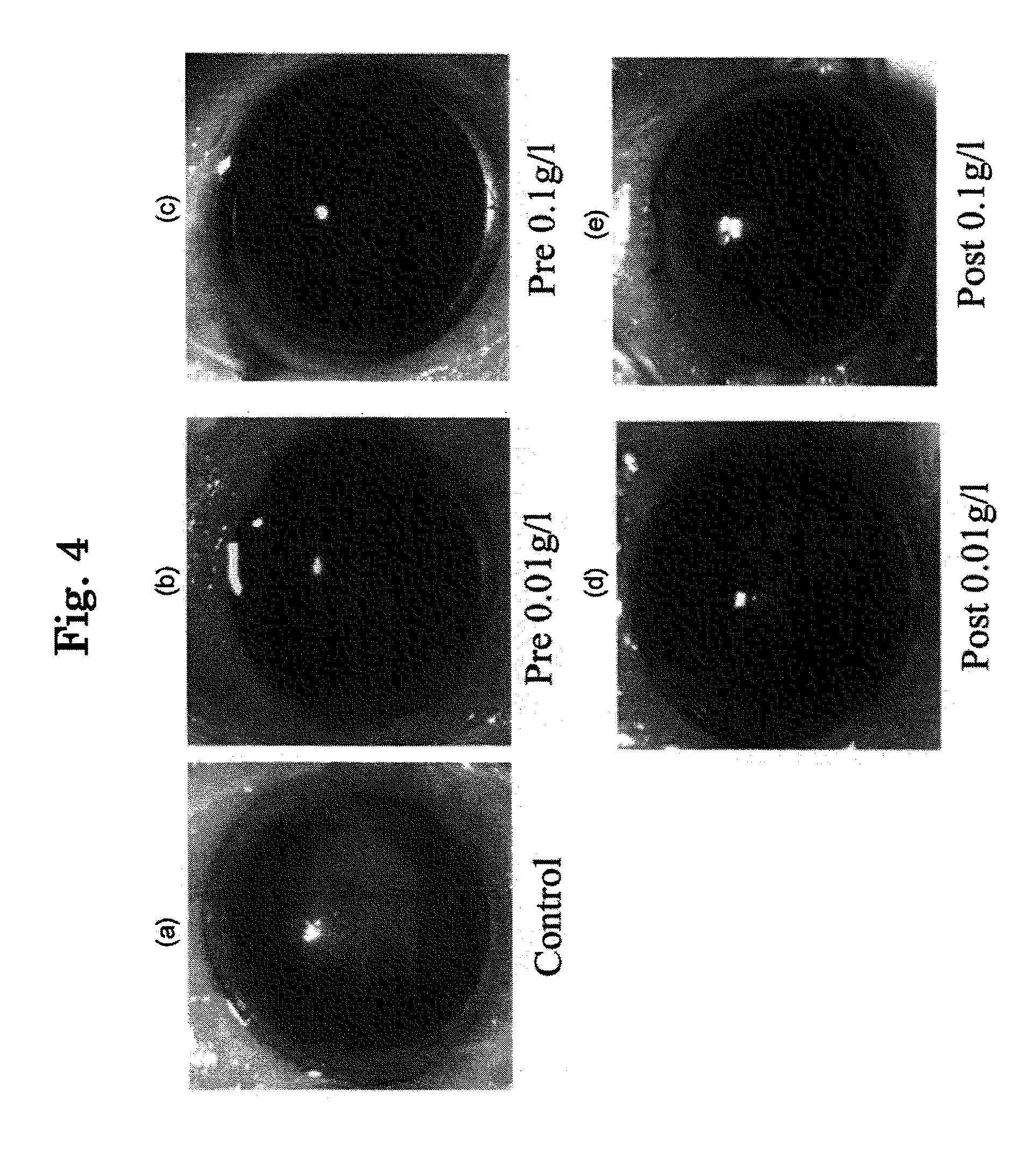 Agent for treating eye diseases