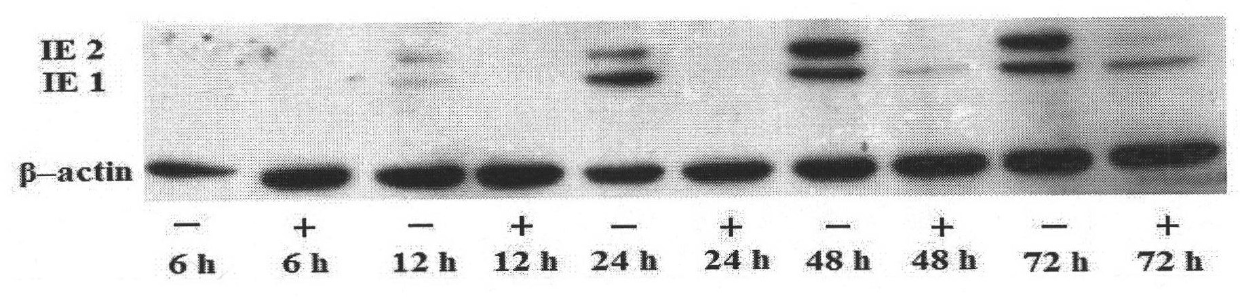 Notoginseng extract and application thereof