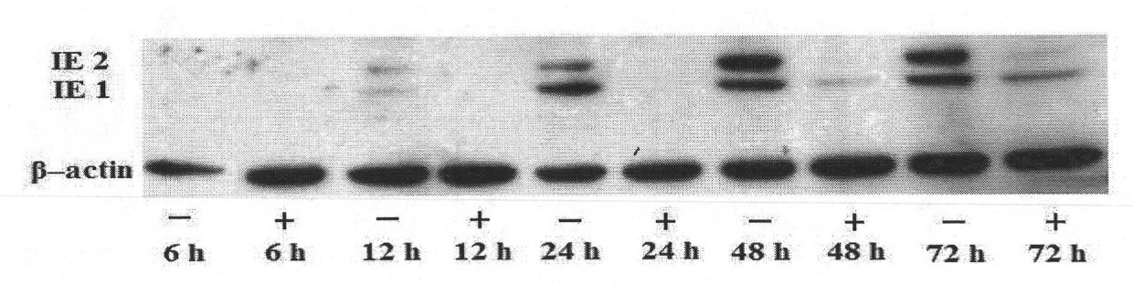 Notoginseng extract and application thereof