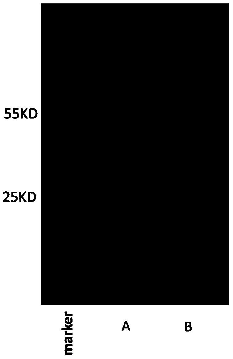 Human anti-HBV surface antigen genetic engineering antibody, and preparation method and application thereof