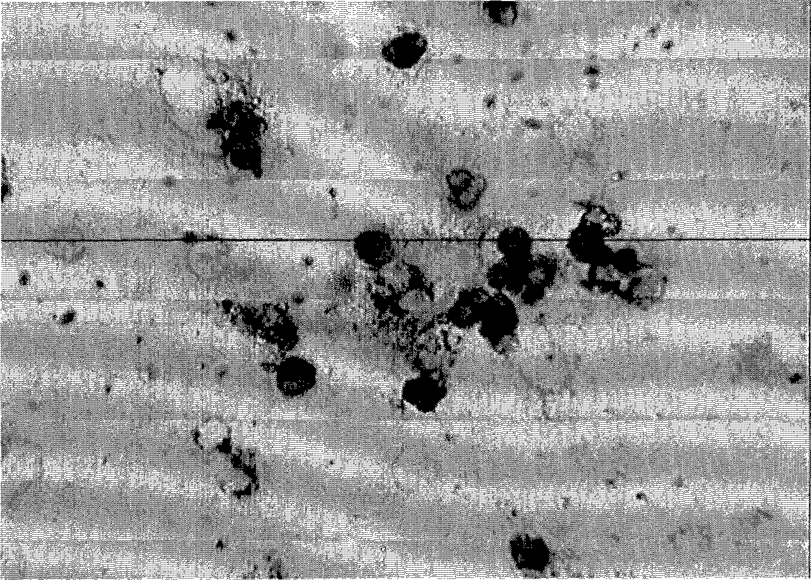 In situ hybridization detection kit for early carcinoma of prostate, detecting method and use thereof