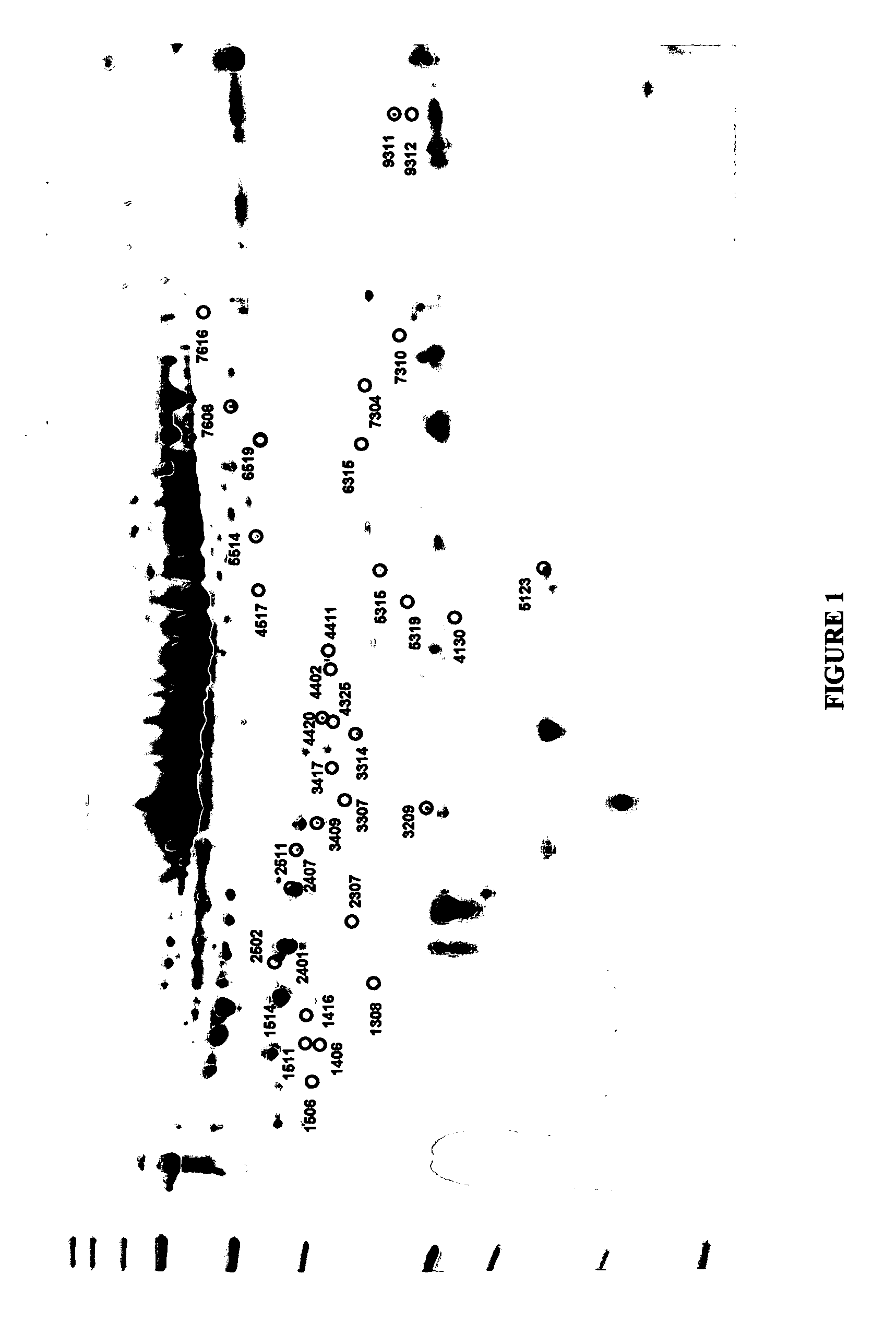 Assay for ALS and ALS-like disorders