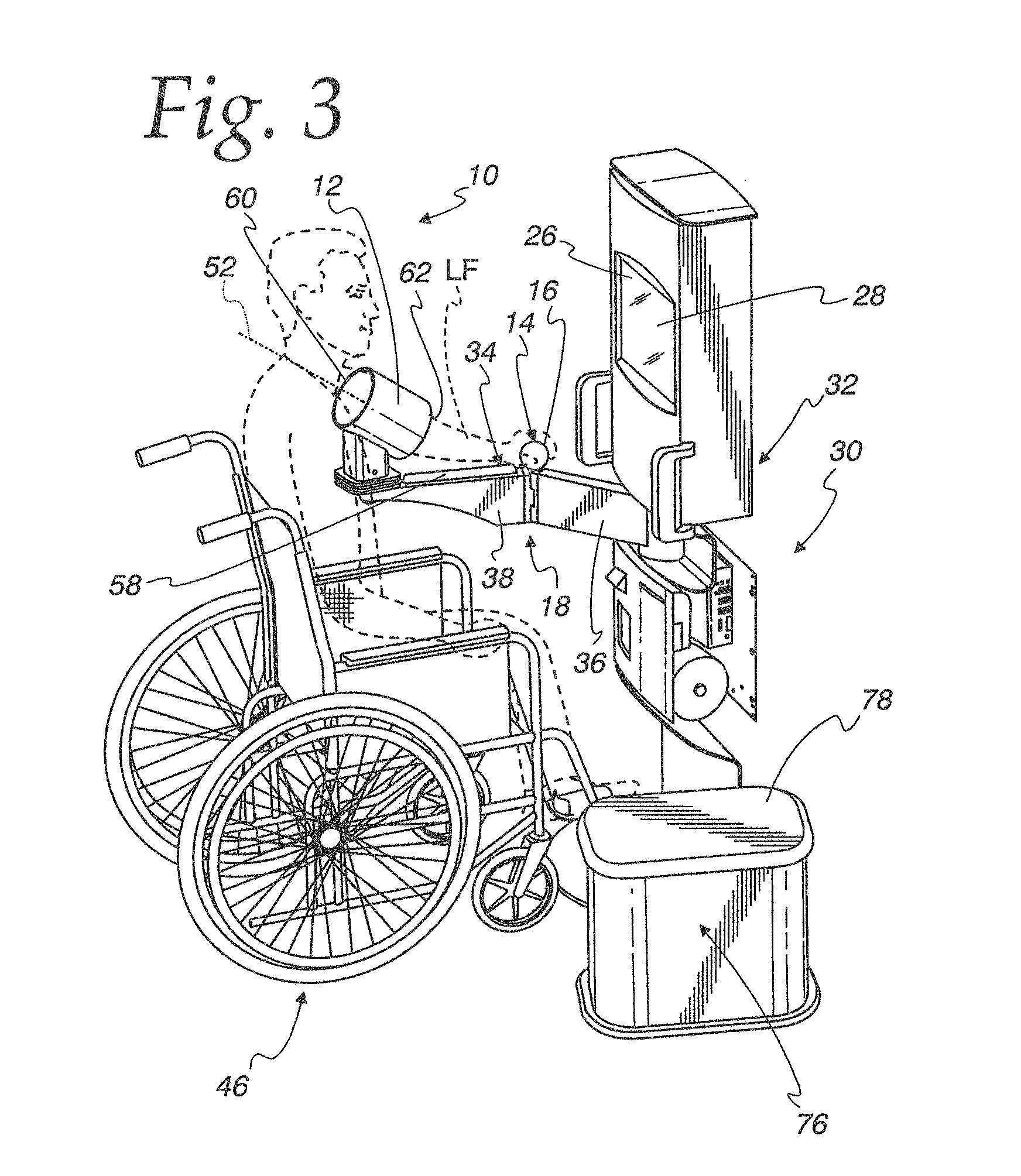 System for facilitating the measurement of blood pressure and method of measuring blood pressure utilizing the system