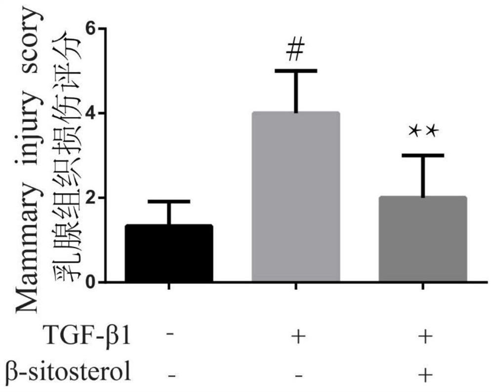 Experimental method of [beta]-sitosterol for relieving breast fibrosis diseases